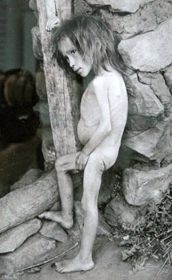 Girl_affected_by_famine_in_Buguruslan%2C_Russia_-_1921.jpg